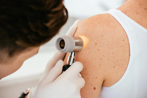 Dermatology Care